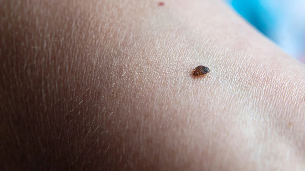 bed bug on body